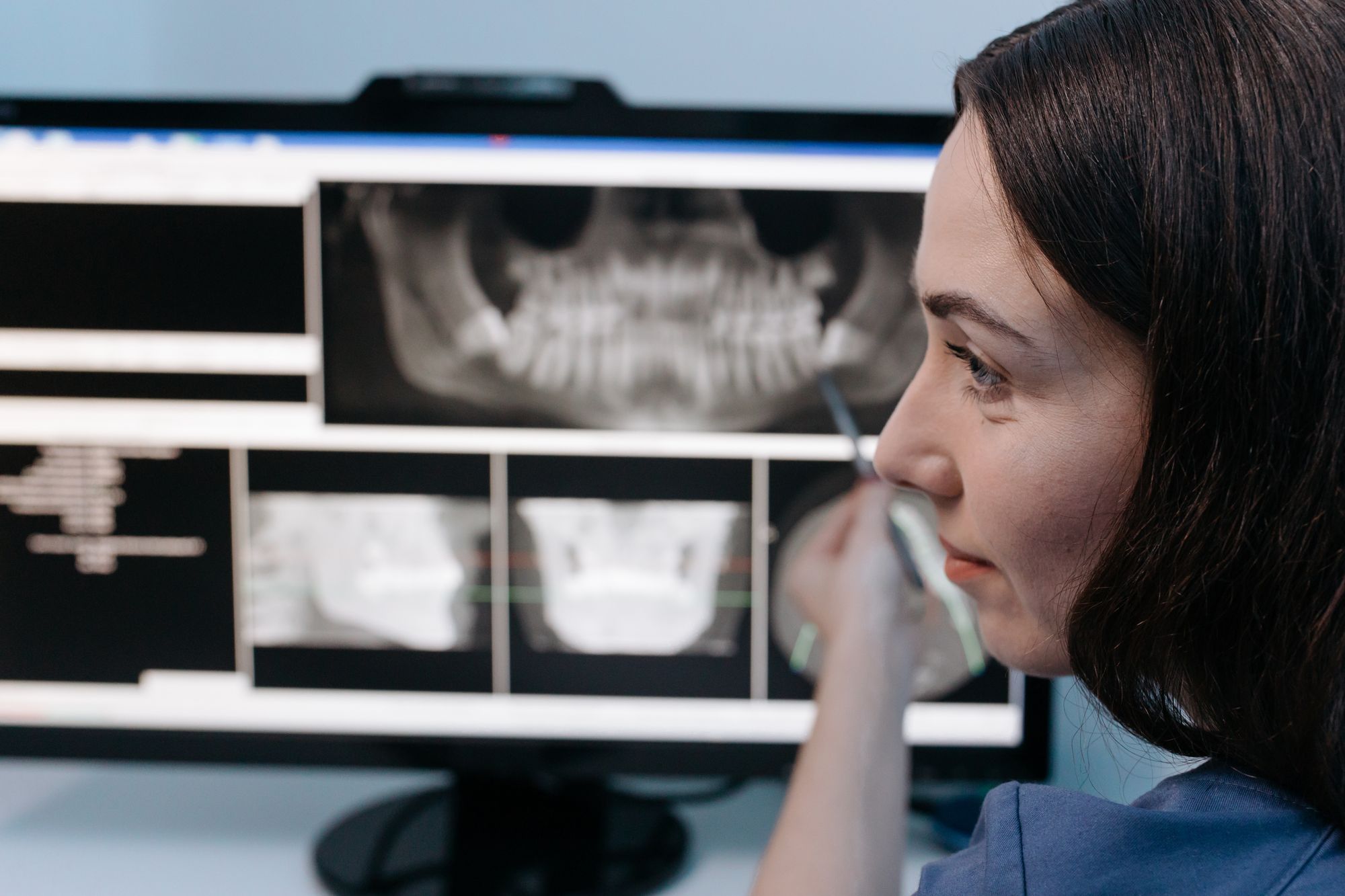 Dentist reviewing a panoramic dental X-ray on a computer screen